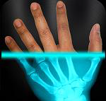 Wilhelm Conrad Rntgen