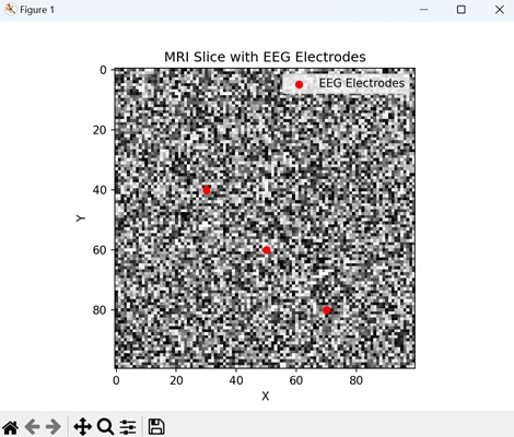 MRI Overlay with EEG Electrodes